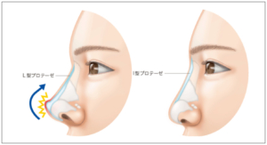 緒形りょう　鼻　整形　仙道敦子