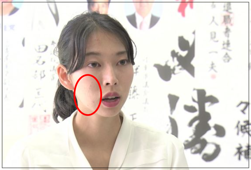 今井瑠々　肌　選挙　かわいい　画像